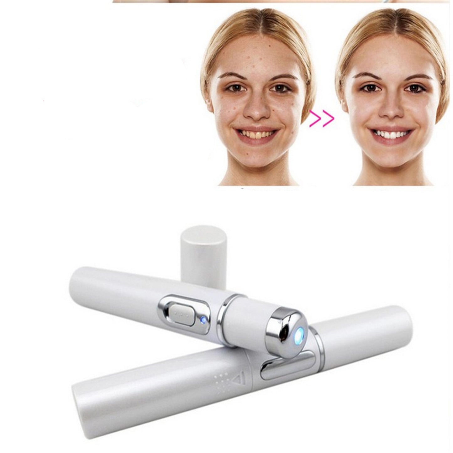 Wrinkle & Acne Scar Remover Pen (Blemish Pore)